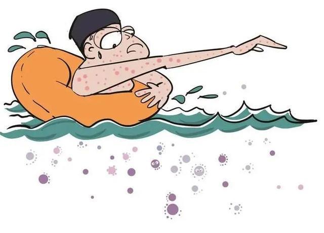 1762482758659428.jpeg 游泳池細菌2.jpeg